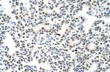 Anti-HNRPA3 antibody, N-term used in IHC (Paraffin sections) (IHC-P). GTX47187