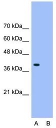 Anti-HNRPA3 antibody, N-term used in Western Blot (WB). GTX47187