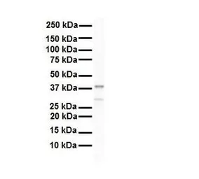 Anti-HNRPA3 antibody, N-term used in Western Blot (WB). GTX47187