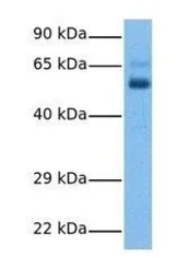 Anti-CPEB2 antibody, Internal used in Western Blot (WB). GTX47192