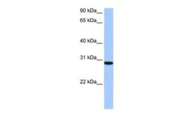 Anti-RALYL antibody, C-term used in Western Blot (WB). GTX47193