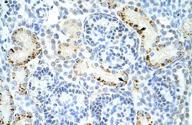 Anti-DAZAP1 antibody, C-term used in IHC (Paraffin sections) (IHC-P). GTX47199
