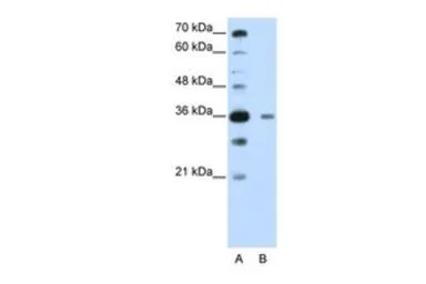 Anti-DAZAP1 antibody, C-term used in Western Blot (WB). GTX47199