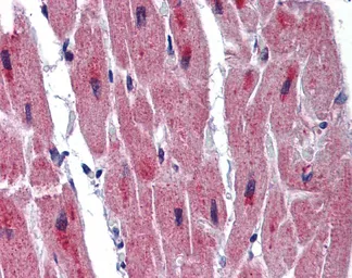 Anti-RBM24 antibody, Internal used in IHC (Paraffin sections) (IHC-P). GTX47201