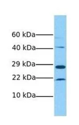 Anti-RBM24 antibody, Internal used in Western Blot (WB). GTX47201