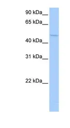 Anti-RBM45 antibody, Internal used in Western Blot (WB). GTX47202