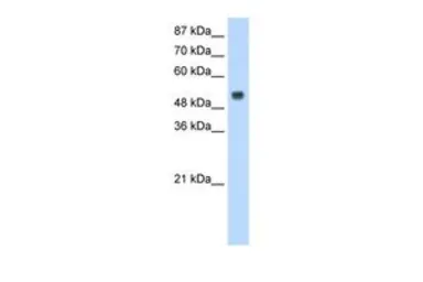 Anti-RBM45 antibody, N-term used in Western Blot (WB). GTX47203