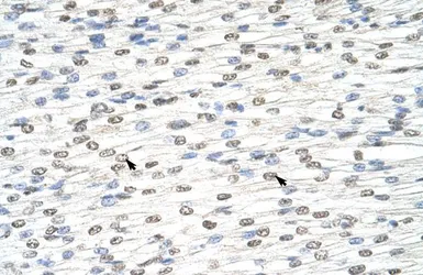 Anti-DIS3L2 antibody, N-term used in IHC (Paraffin sections) (IHC-P). GTX47208