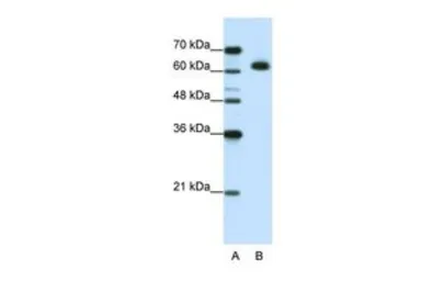 Anti-DIS3L2 antibody, N-term used in Western Blot (WB). GTX47208