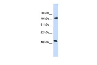 Anti-APOBEC3F antibody, C-term used in Western Blot (WB). GTX47211