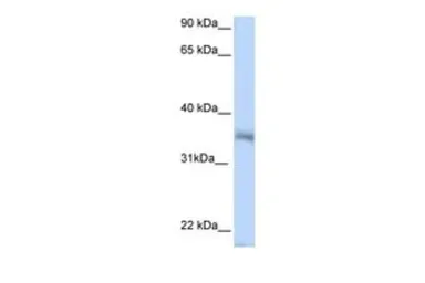 Anti-HEXIM2 antibody, N-term used in Western Blot (WB). GTX47216