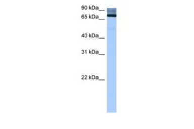 Anti-ADAD2 antibody, Internal used in Western Blot (WB). GTX47218