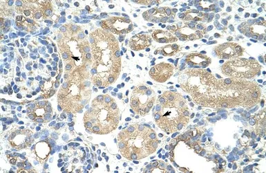Anti-RAVER1 antibody, N-term used in IHC (Paraffin sections) (IHC-P). GTX47224