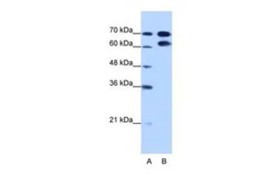 Anti-RAVER1 antibody, N-term used in Western Blot (WB). GTX47224