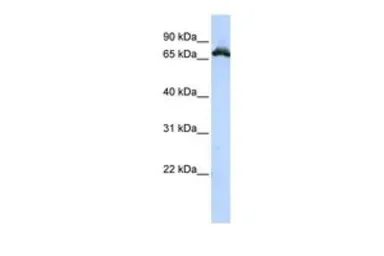 Anti-RAVER1 antibody, Internal used in Western Blot (WB). GTX47225