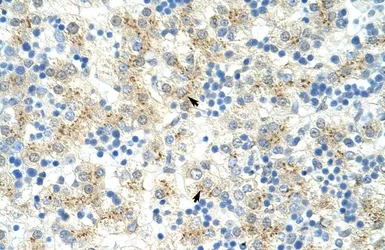 Anti-EXOSC6 antibody, N-term used in IHC (Paraffin sections) (IHC-P). GTX47229