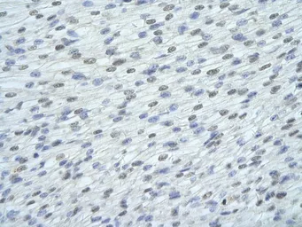 Anti-FUSIP1 antibody, C-term used in IHC (Paraffin sections) (IHC-P). GTX47232