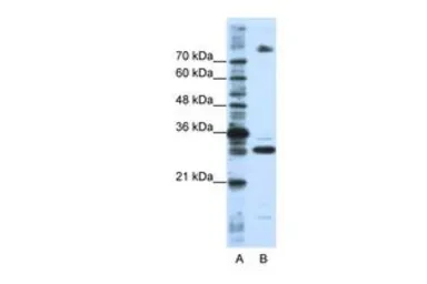 Anti-FUSIP1 antibody, C-term used in Western Blot (WB). GTX47232