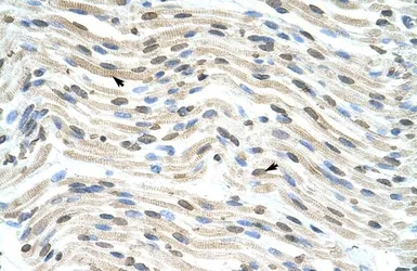Anti-THOC3 antibody, Internal used in IHC (Paraffin sections) (IHC-P). GTX47239