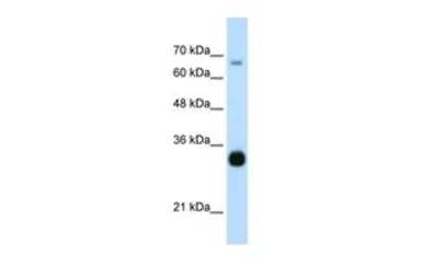 Anti-THOC3 antibody, Internal used in Western Blot (WB). GTX47239