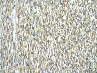 Anti-hnRNP A2B1 antibody, N-term used in IHC (Paraffin sections) (IHC-P). GTX47243