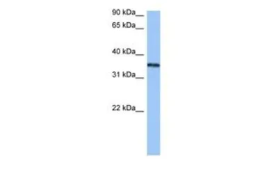 Anti-hnRNP A2B1 antibody, N-term used in Western Blot (WB). GTX47243