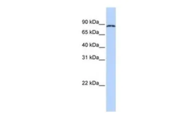 Anti-CPEB4 antibody, N-term used in Western Blot (WB). GTX47246