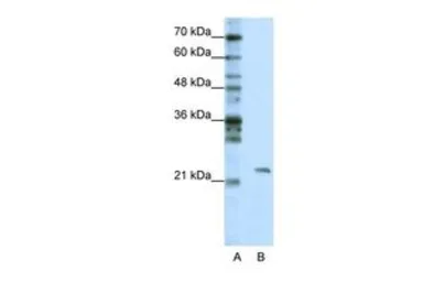 Anti-MRM1 antibody, C-term used in Western Blot (WB). GTX47250