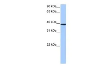 Anti-MRM1 antibody, C-term used in Western Blot (WB). GTX47251