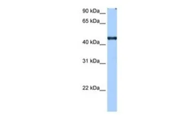 Anti-RBM42 antibody, C-term used in Western Blot (WB). GTX47253