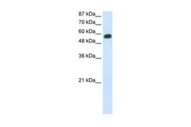 Anti-NOC4L antibody, C-term used in Western Blot (WB). GTX47257