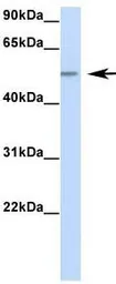 Anti-RBM47 antibody, Internal used in Western Blot (WB). GTX47272