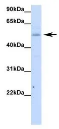 Anti-RBM47 antibody, Internal used in Western Blot (WB). GTX47272