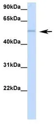 Anti-RBM47 antibody, Internal used in Western Blot (WB). GTX47272