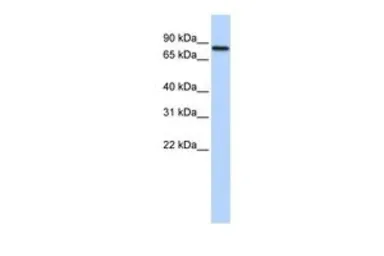 Anti-ADARB2 antibody, Internal used in Western Blot (WB). GTX47280