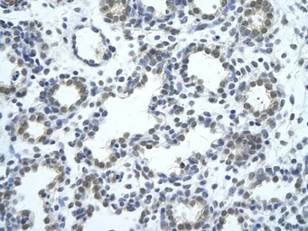 Anti-SRBD1 antibody, N-term used in IHC (Paraffin sections) (IHC-P). GTX47284