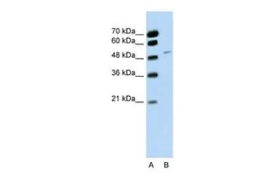 Anti-RBM22 antibody, C-term used in Western Blot (WB). GTX47285