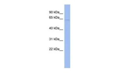 Anti-CDKN2AIP antibody, N-term used in Western Blot (WB). GTX47293