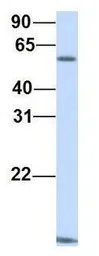 Anti-CDKN2AIP antibody, N-term used in Western Blot (WB). GTX47293