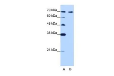 Anti-CDKN2AIP antibody, C-term used in Western Blot (WB). GTX47294