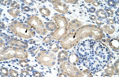 Anti-RBM38 antibody, N-term used in IHC (Paraffin sections) (IHC-P). GTX47297