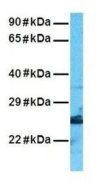 Anti-RBM38 antibody, N-term used in Western Blot (WB). GTX47297