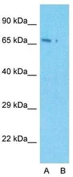 Anti-LARP7 antibody, C-term used in Western Blot (WB). GTX47301