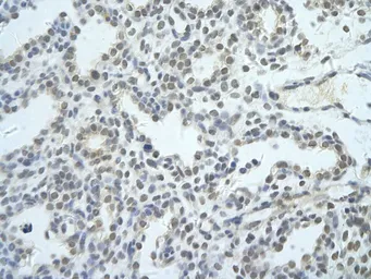 Anti-NIP7 antibody, Internal used in IHC (Paraffin sections) (IHC-P). GTX47306