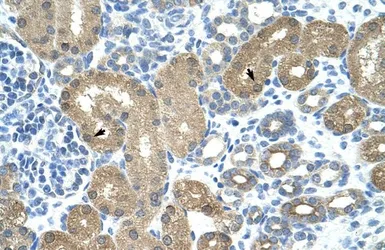 Anti-TRNT1 antibody, N-term used in IHC (Paraffin sections) (IHC-P). GTX47307