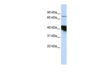 Anti-KIAA0427 antibody, N-term used in Western Blot (WB). GTX47315