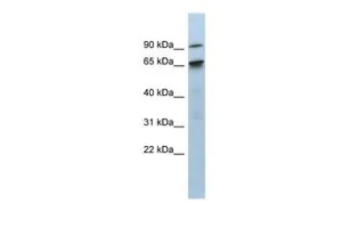 Anti-KIAA0427 antibody, N-term used in Western Blot (WB). GTX47316
