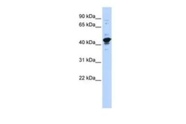 Anti-RBMXL2 antibody, Internal used in Western Blot (WB). GTX47319