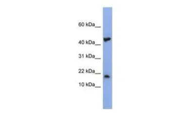Anti-LSM1 antibody, Internal used in Western Blot (WB). GTX47320