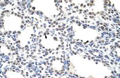 Anti-CSDC2 antibody, N-term used in IHC (Paraffin sections) (IHC-P). GTX47321